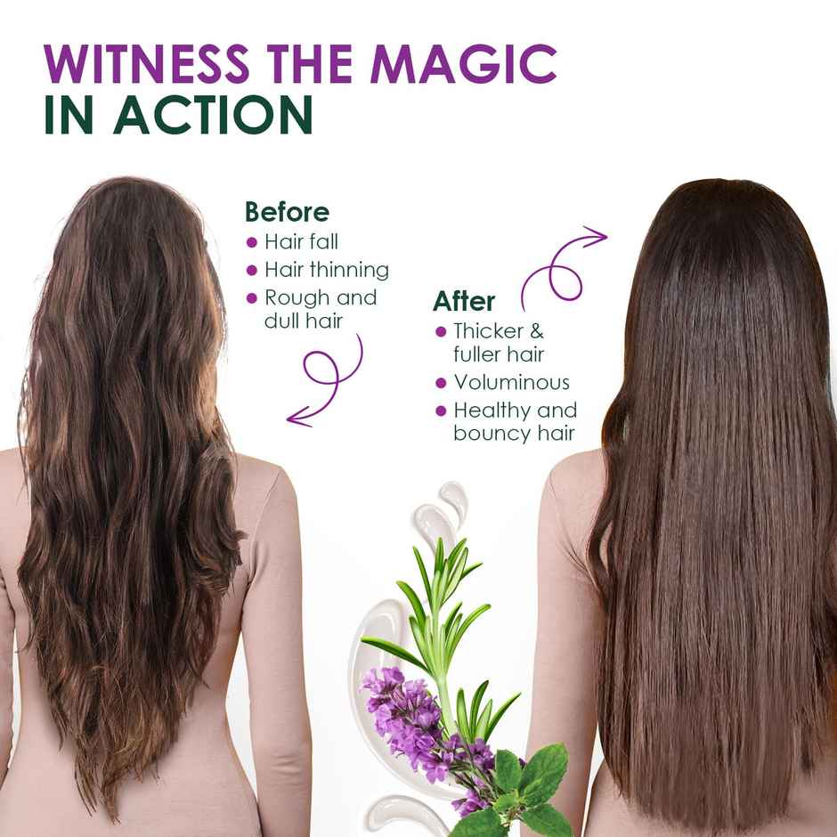 Kesh King Rosemary Oil With Tulsi For Hair Growth & Damage Repair Boosts Hair Growth