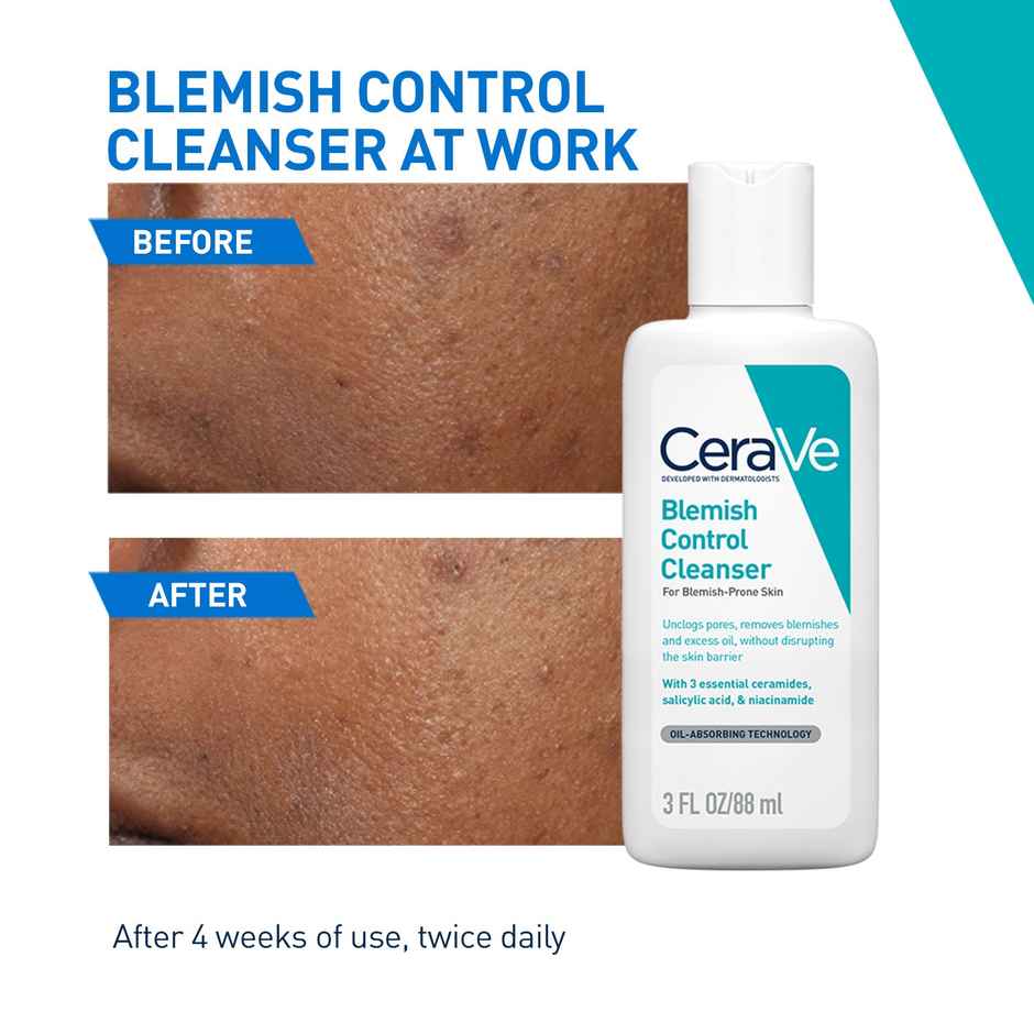 Cerave Blemish Control Cleanser With 2% Salicylic Acid & Niacinamide For Acne-Prone Skin