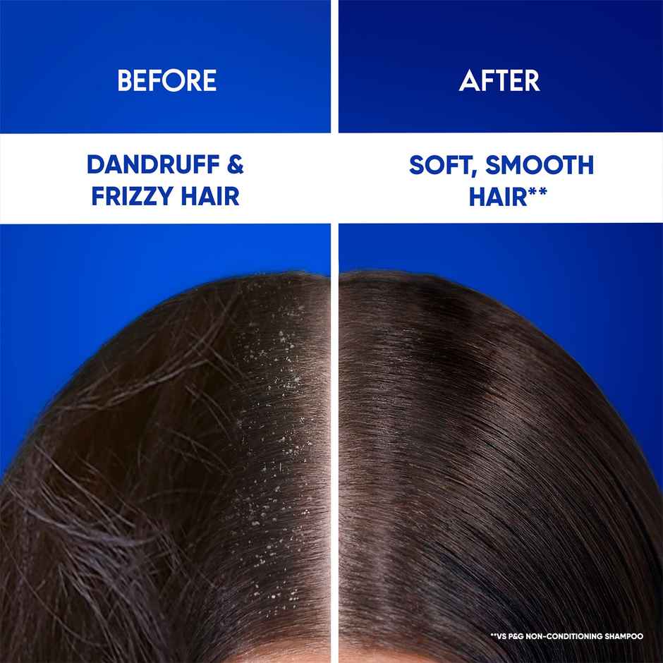Head & Shoulders 2-In-1 Smooth And Silky Anti Dandruff Shampoo + Conditioner For Women & Men