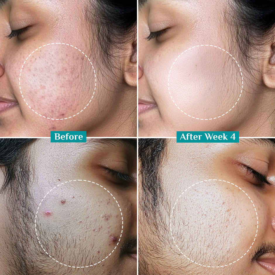 Pilgrim Pilgrim 2% Kojic Acid Serum