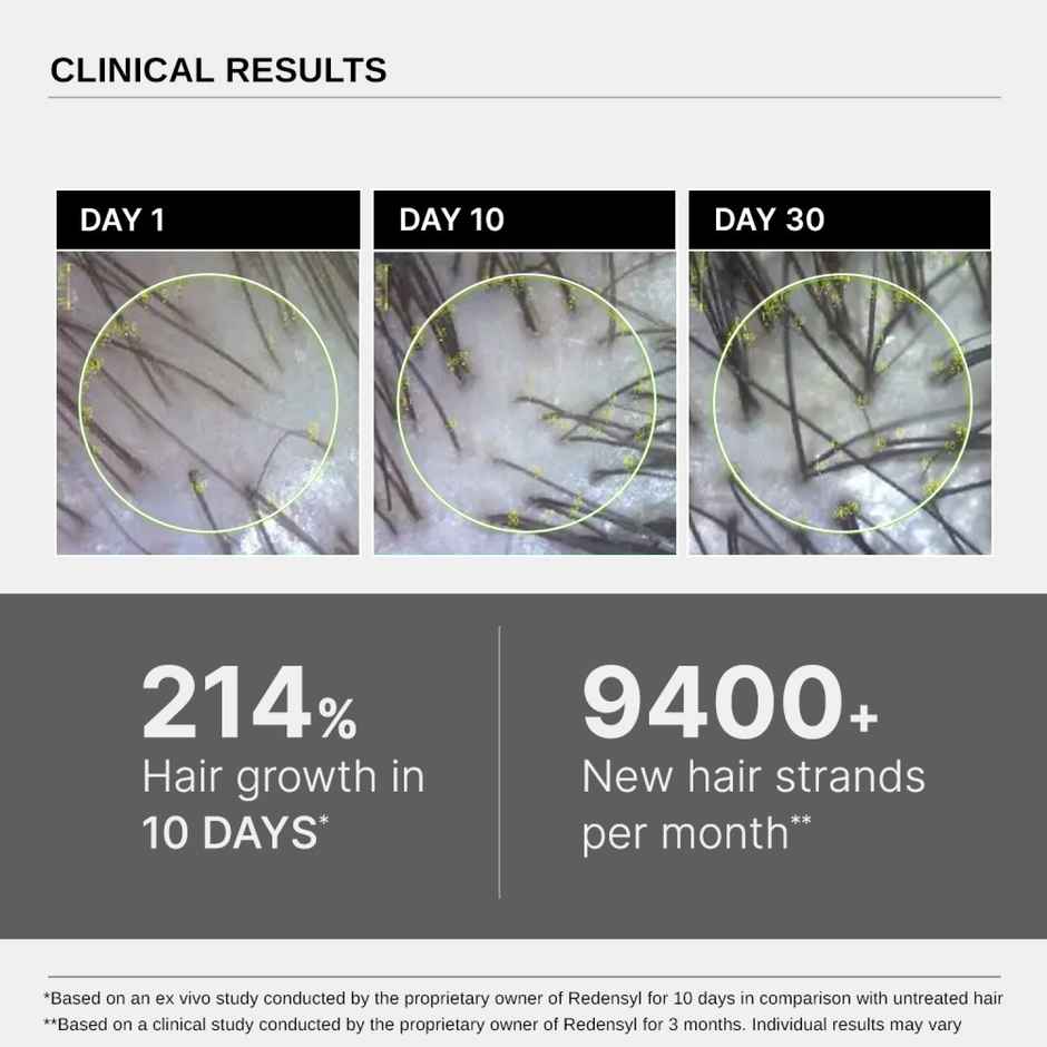 Bare Anatomy Advanced Hair Growth Serum For Scalp - 3% Redensyl + 4% Anagain + 3% Baicapil