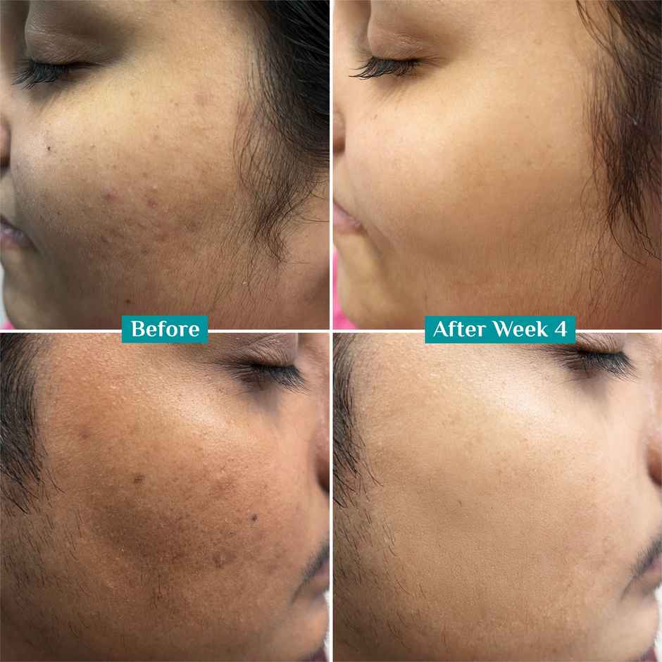 Pilgrim 10% Vitamin C Face Serum For Daily Brightness Helps Reduce Dark Spots & Evens Skin Tone