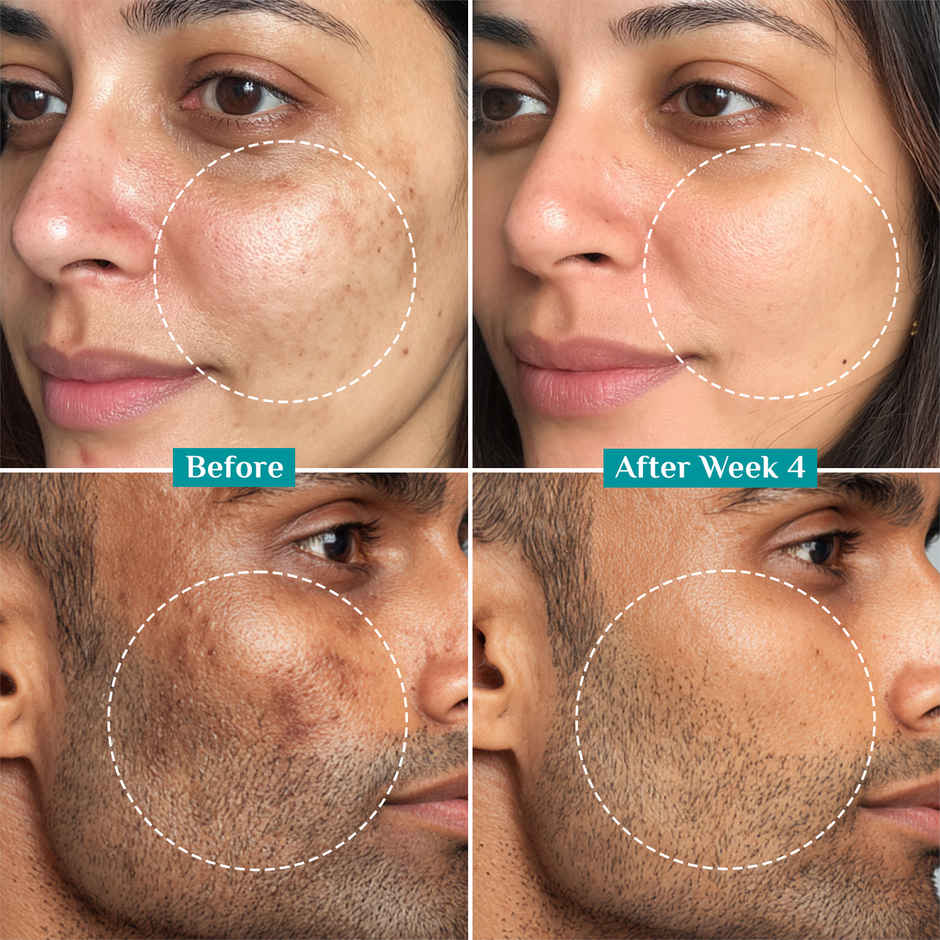 Pilgrim 15% Vitamin C Face Serum For Advanced Brightness