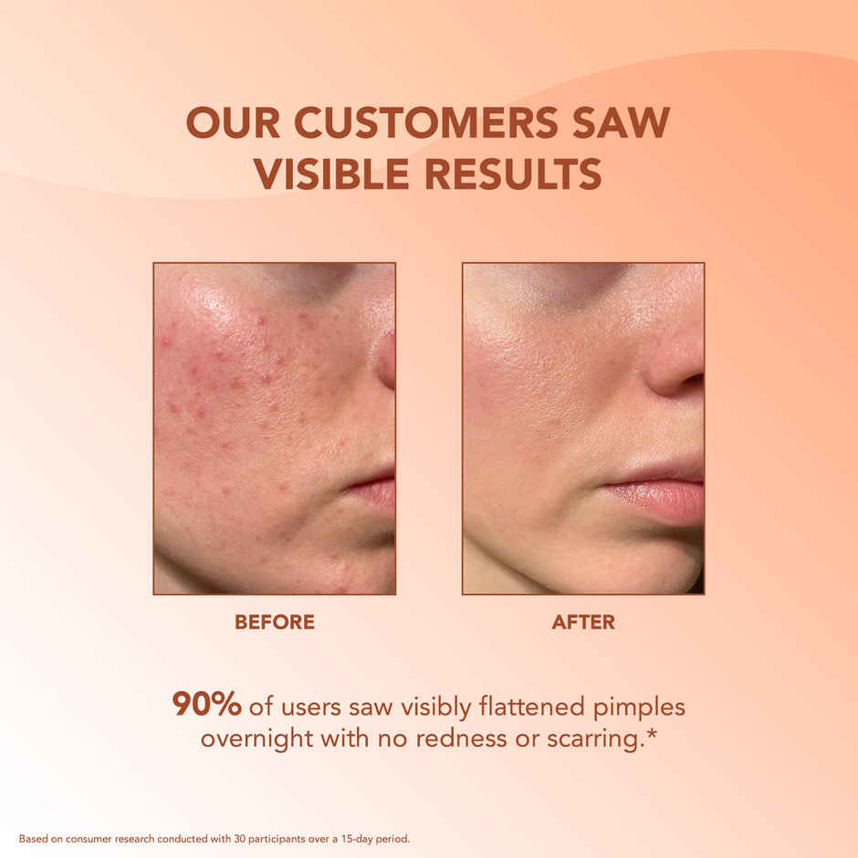 BELLAVITA Acne Patch for Face|Waterproof Patches for Active Acne|Absorbs Pimple Overnigh