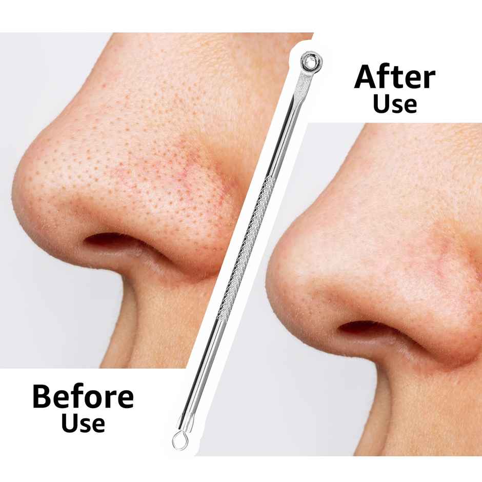 VEGA Black Head Remover, Rounded (BHR-02)