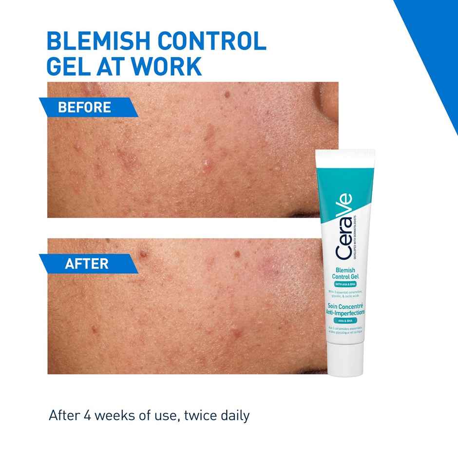 CeraVe Blemish Control Gel With 2% Salicylic Acid, AHA & Niacinamide For Acne Spot Treatment