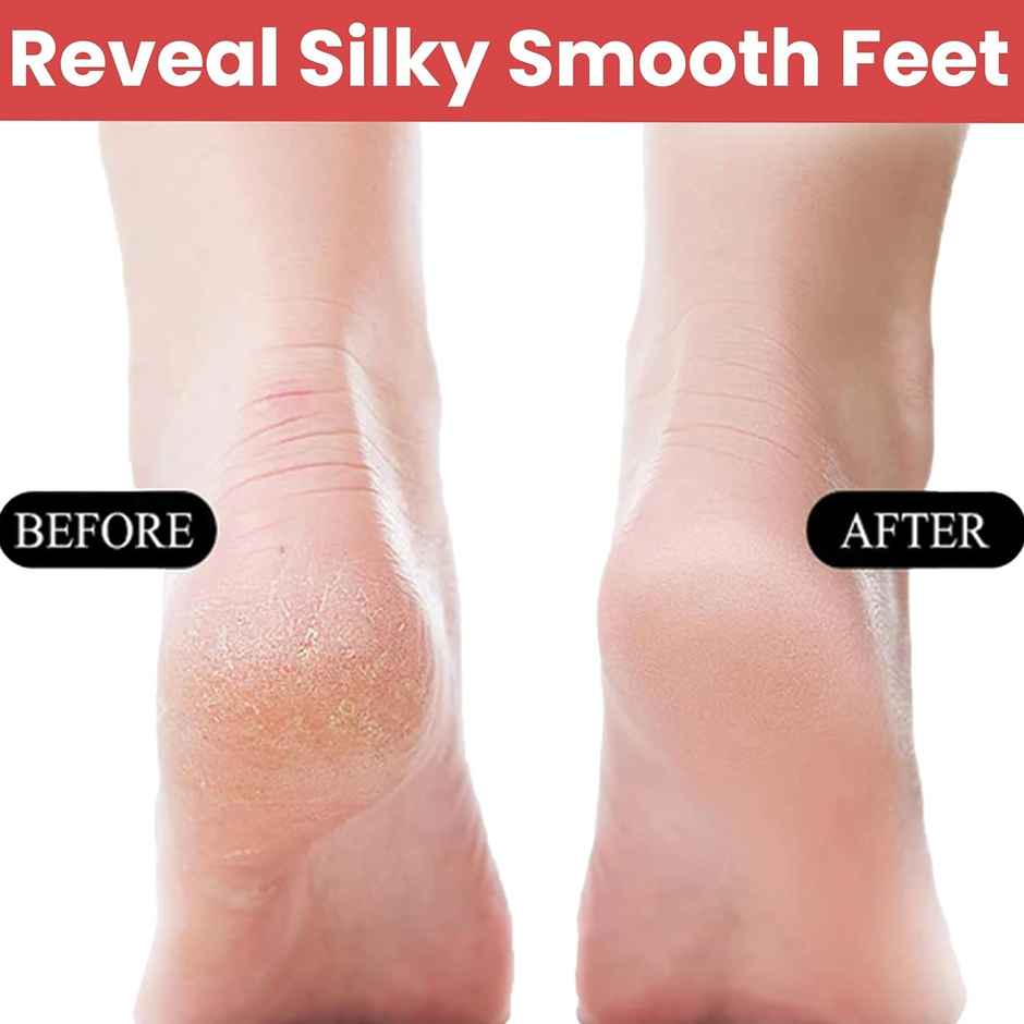 Midazzle 2in1 Wooden Foot Filer/Scrubber and Callus Remover |MIFF5201