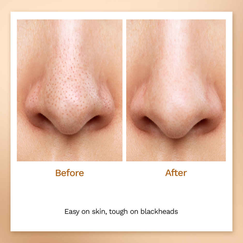 FURR Charcoal Nose Strips