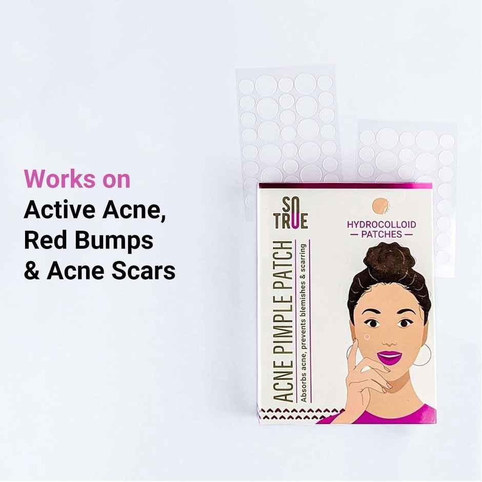 Sotrue Acne Pimple Relief Patches For Face