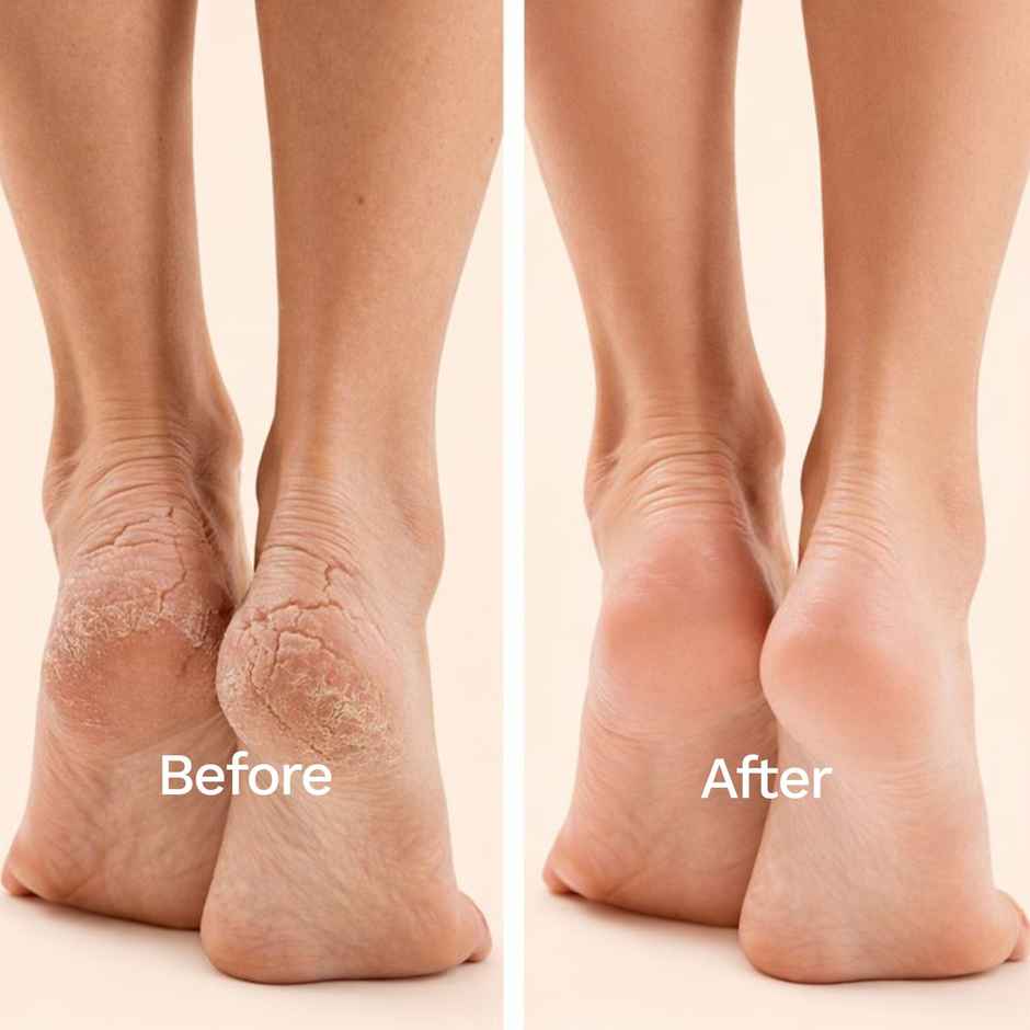 FURR By Pee Safe Peeling & Exfoliating Foot Mask