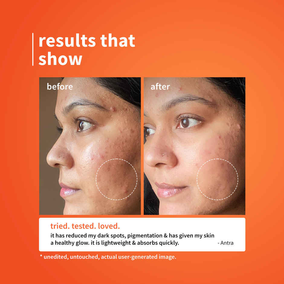 Calendula & 10% Vitamin C Barrier Boosting + Glow Serum | Boosts Glow