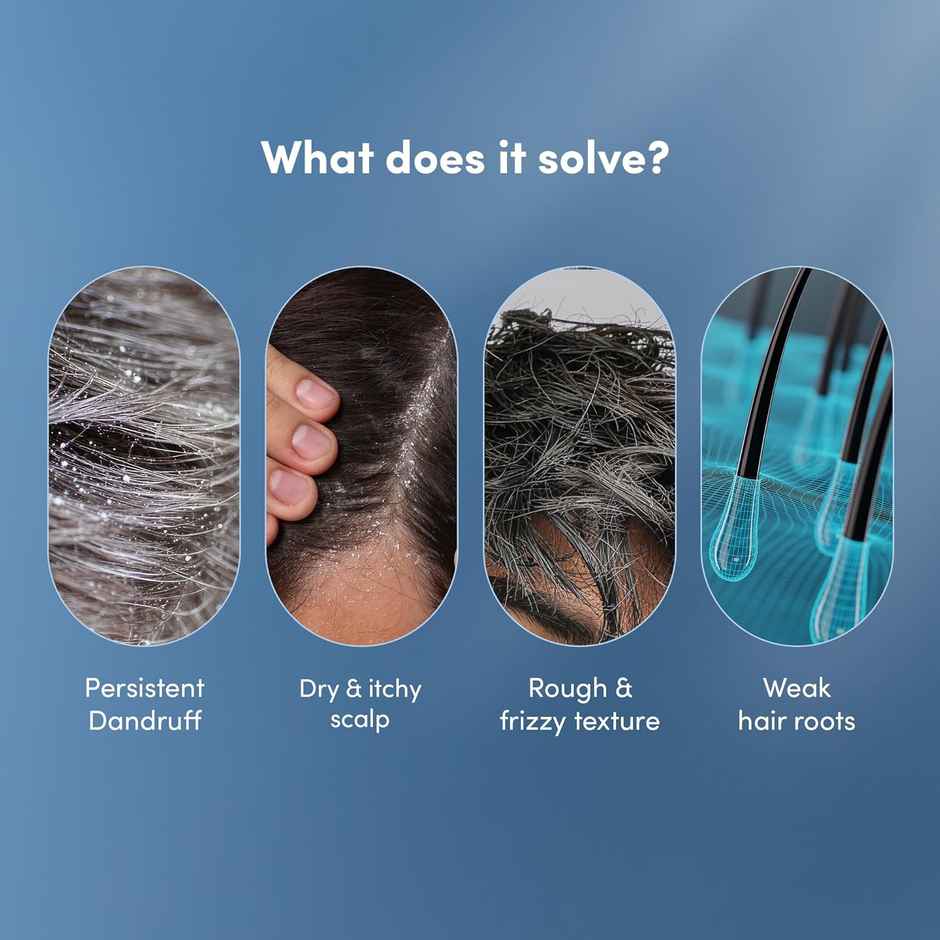 Man Matters Advanced Daily Use Anti Dandruff Shampoo for Men