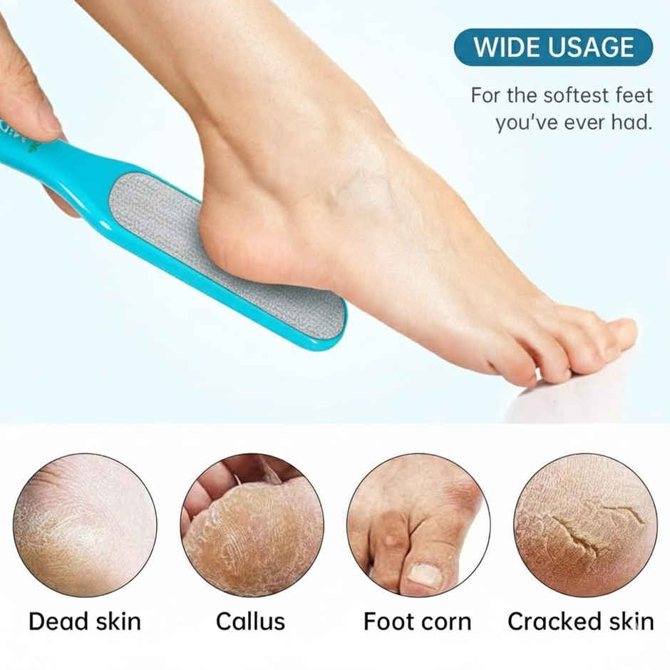 Midazzle 2in1 Foot Filer/Scrubber, Callus Remover |MIFF5203 | Assorted