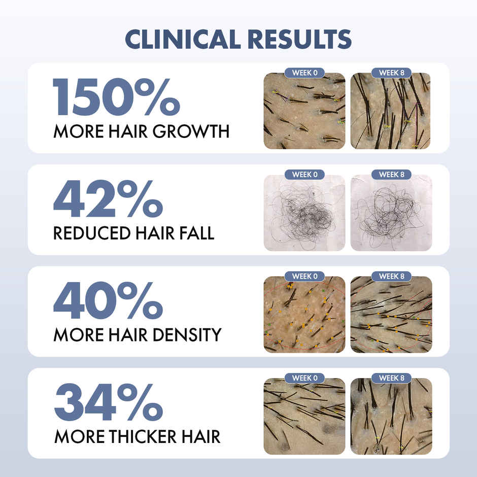 Thriveco Hair Growth Serum 2.0 - For Hair Growth & Hair Fall Control | Men & Women Combo