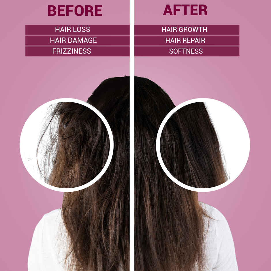 KT Professional Organic Onion Shampoo | Hair Fall Control with Essential Oils & Aloe Vera