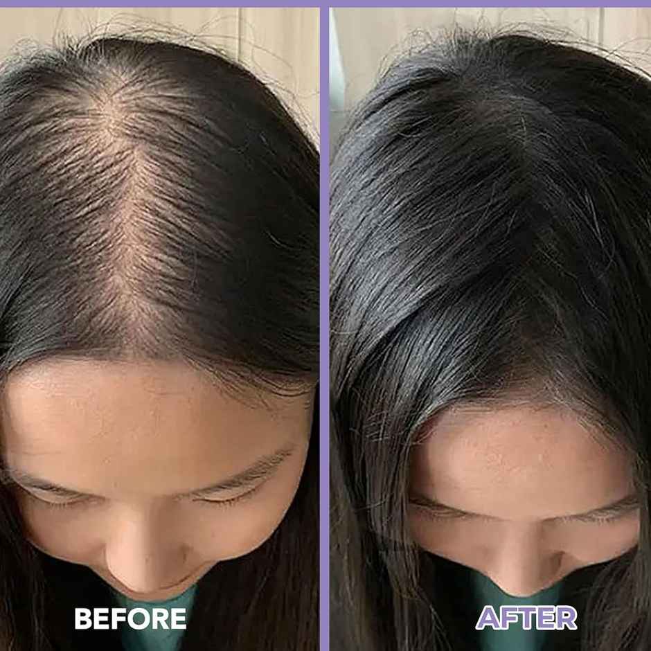 Spring H2O Rosemary Hair Growth Shampoo