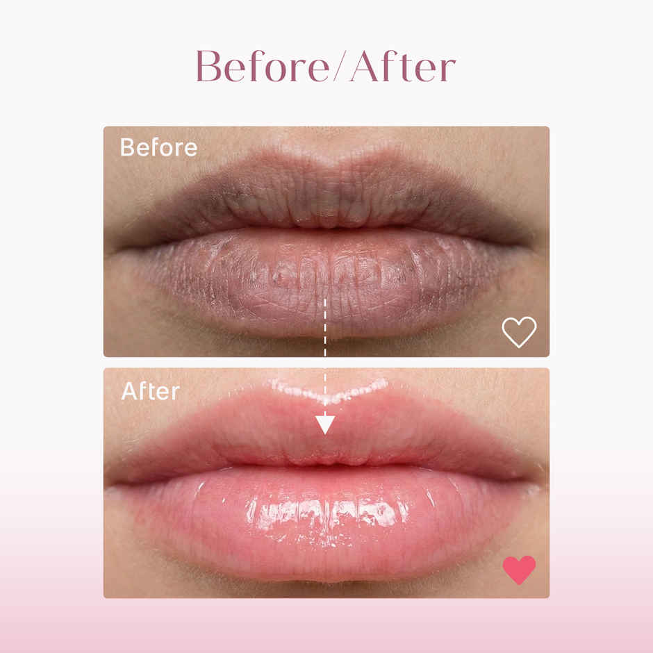 Seoulskin Brightening Lip Balm SPF50 PA++ | Kojic Acid & Niacinamide for Dark Lips Care