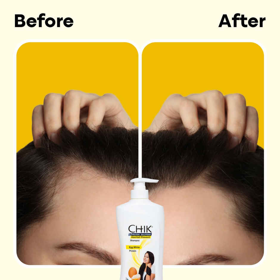Chik Protein Solution Hairfall Prevent Shampoo For Men And Women