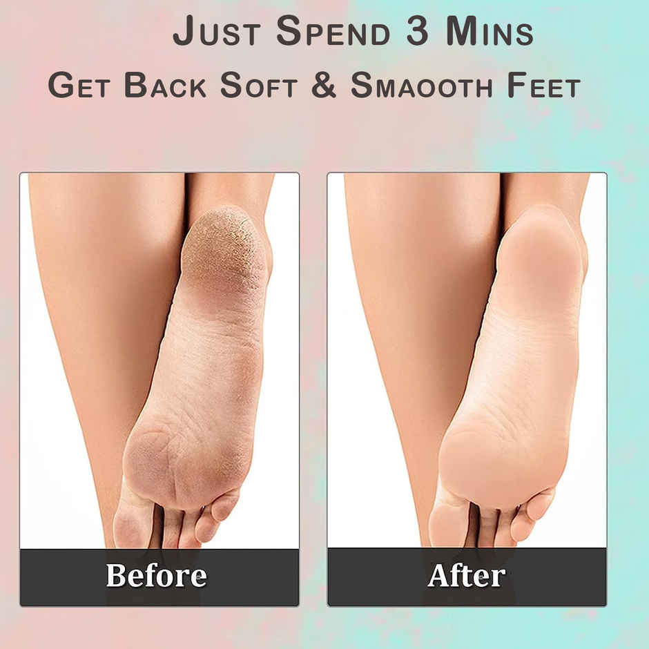 Midazzle 2in1 Foot Filer/Scrubber, Callus Remover |MIFF5203 | Assorted