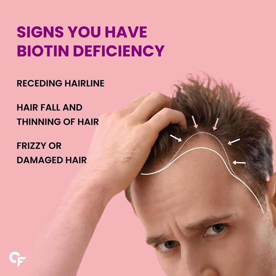 Carbamide Forte Biotinova 10000mcg Biotin Tablet