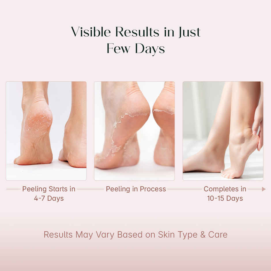 SeoulSkin Glycolic Acid Foot Peeling Mask | Exfoliating Foot Peel | Dead Skin Removal