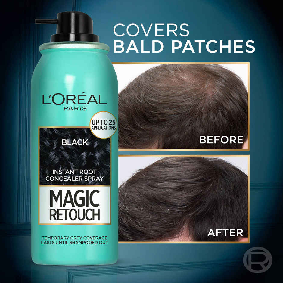 L'Oreal Paris Magic Retouch Root Touch Up Hair Colour Spray, 1 Black