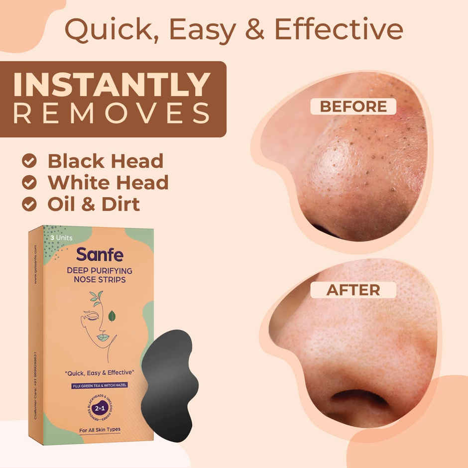 Sanfe Deep Purifying Nose Strips with Green Tea & Witch Hazel