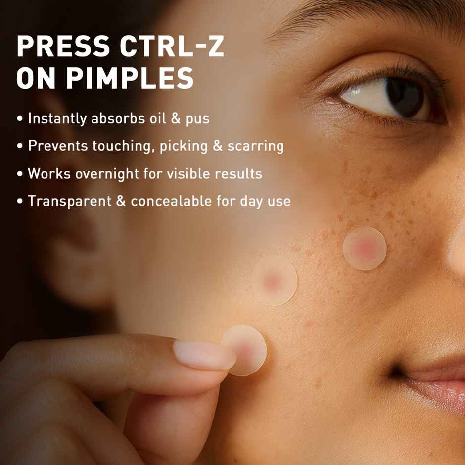 Sirona Acne Pimple Patch For Face For All Skin Types