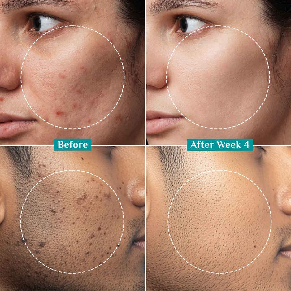 Pilgrim Brightening Skin Face Serum with 2% Alpha Arbutin & 3% Vitamin C