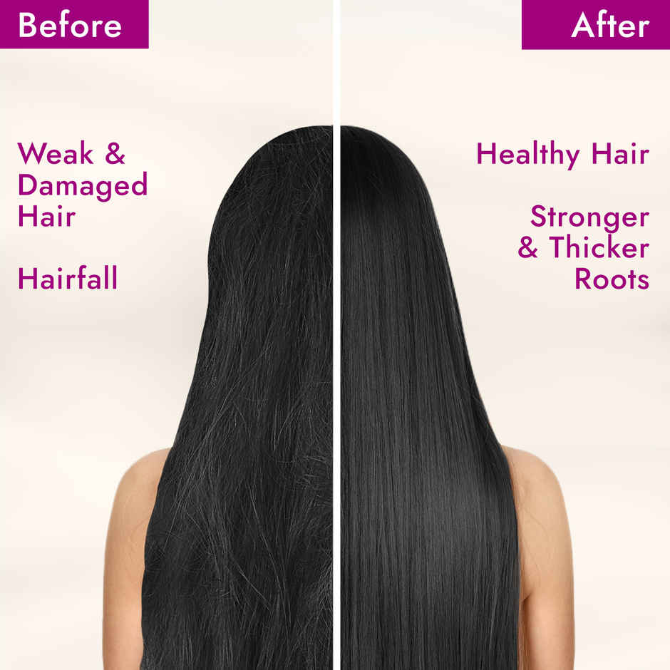 Parachute Advansed Onion Enriched Coconut Hair Oil