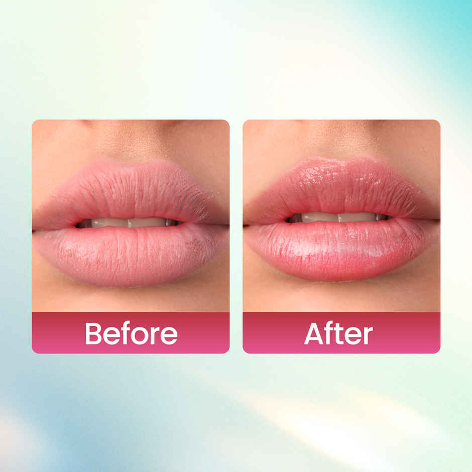 Swiss Beauty Kiss Kandy Lip Balm With Olive Oil | Moisturising Soft & Smooth Lips - 02 Water Melon