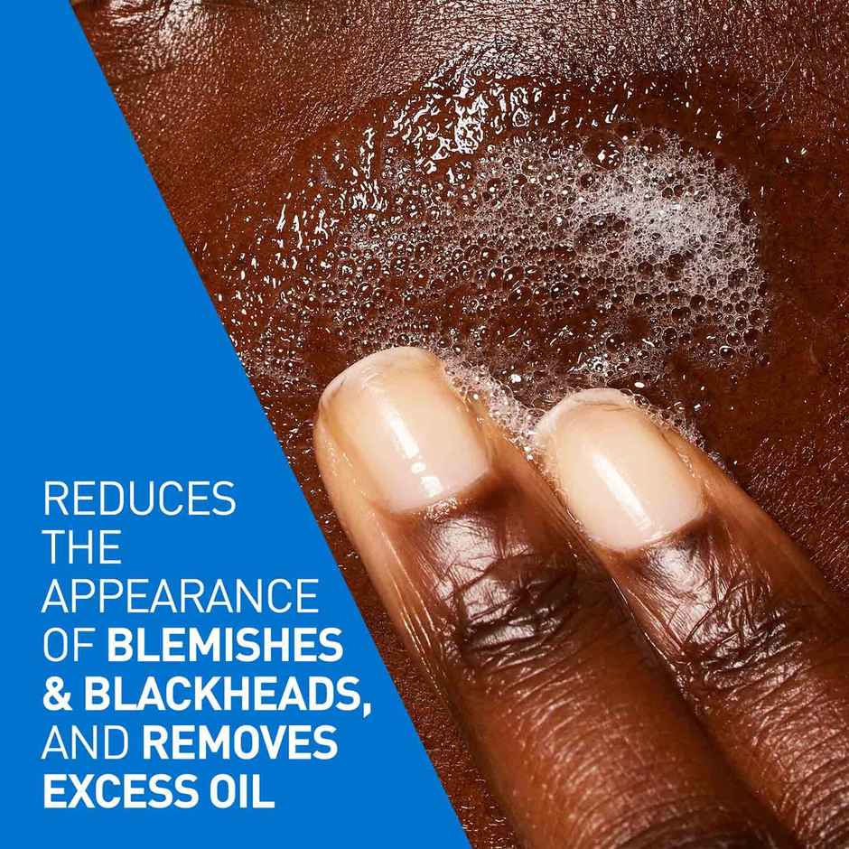 CeraVe Blemish Control Cleanser Face Wash With 2% Salicylic Acid & Niacinamide For Acne-Prone Skin