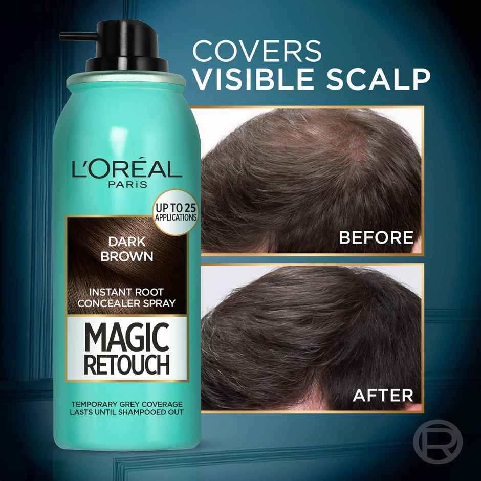 L'Oreal Paris Magic Retouch Root Touch Up Hair Colour Spray, 2 Dark Brown