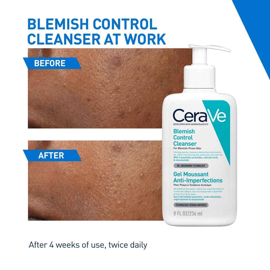 CeraVe Blemish Control Cleanser With 2% Salicylic Acid & Niacinamide For Acne-Prone Skin