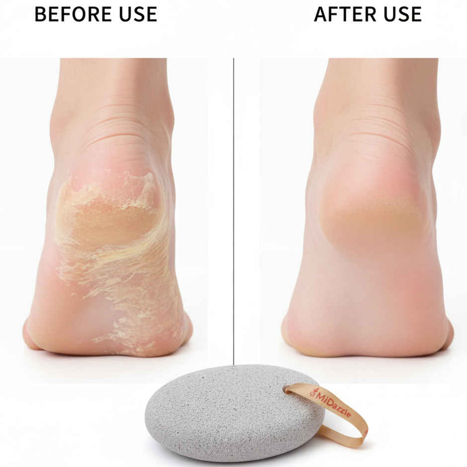 Midazzle Oval Shaped Pumice Stone - Medium |MIPS5104