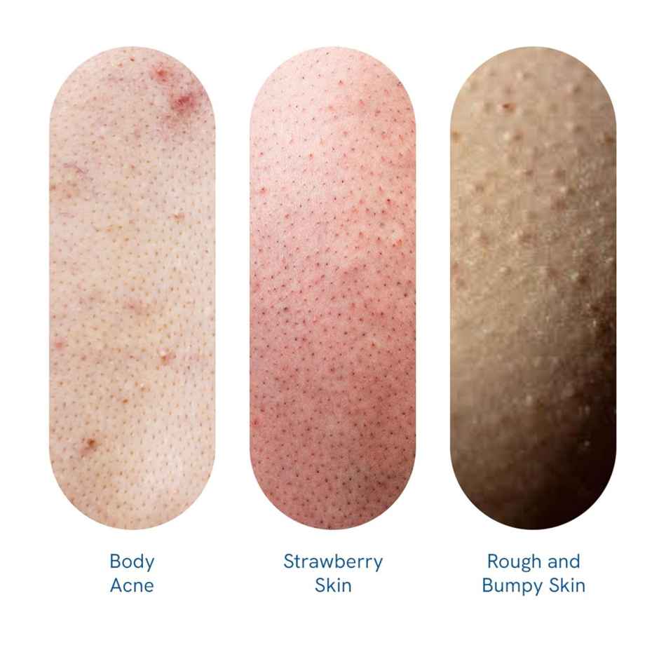 Be Bodywise 1% Salicylic Acid Body Wash & Loofah