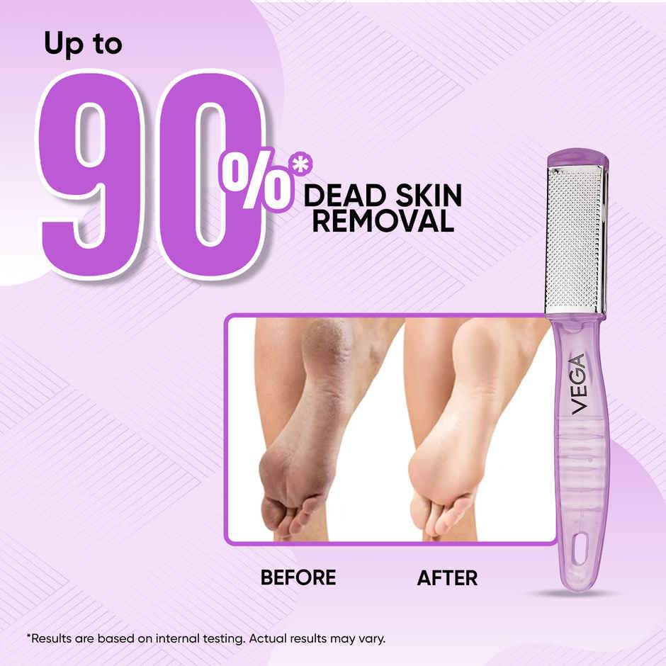 VEGA Pedicure File- Dual Side | Color May Vary | (Pd-03)