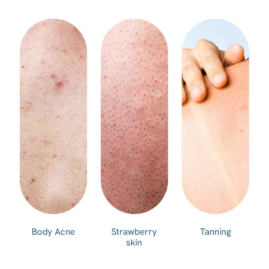 Be Bodywise 10% Aha Body Scrub - Reduces Strawberry Skin, Exfoliates