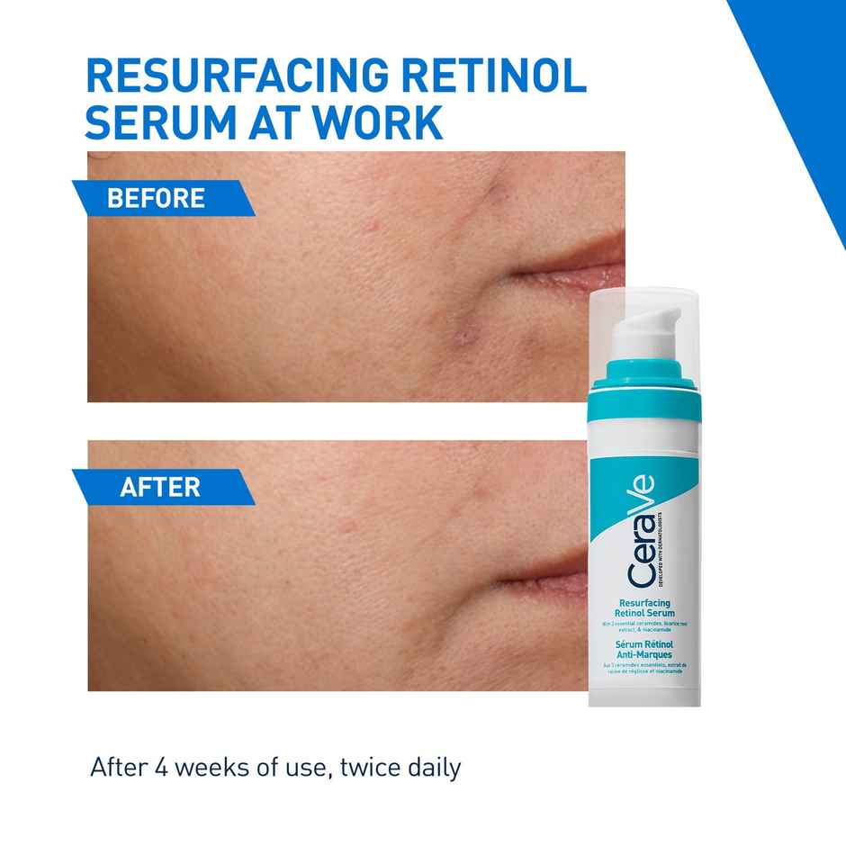 CeraVe Resurfacing Retinol Serum, Reduces Acne Marks With Licorice Root Extract & Niacinamide