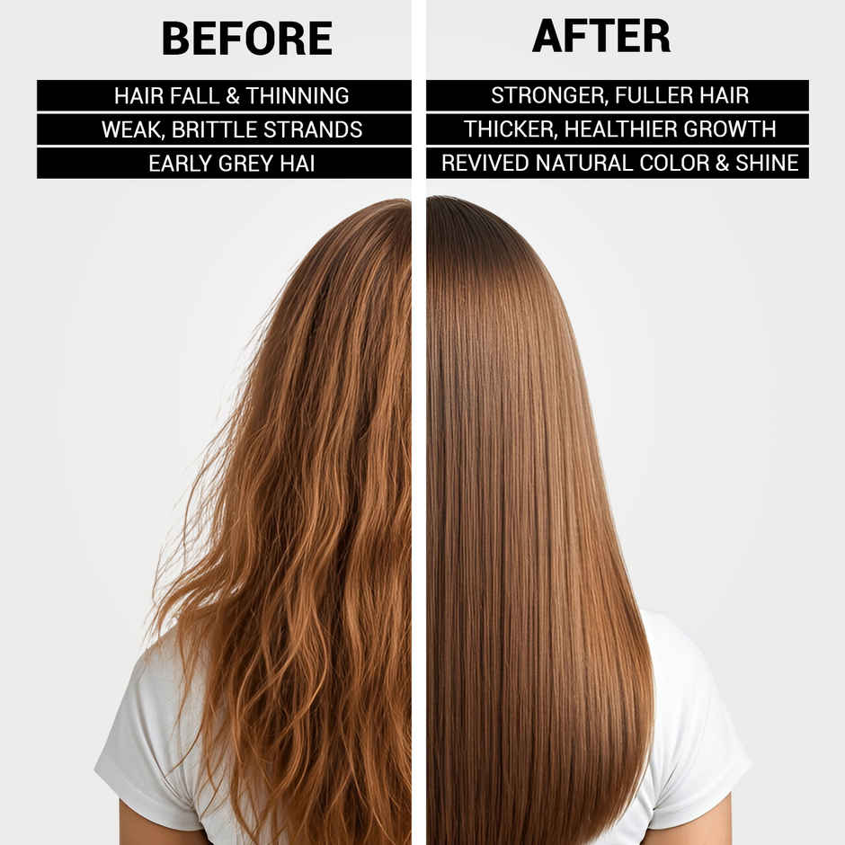 KT Professional The Fit Hair Serum | Hair Strengthening with Black Nigella Seeds
