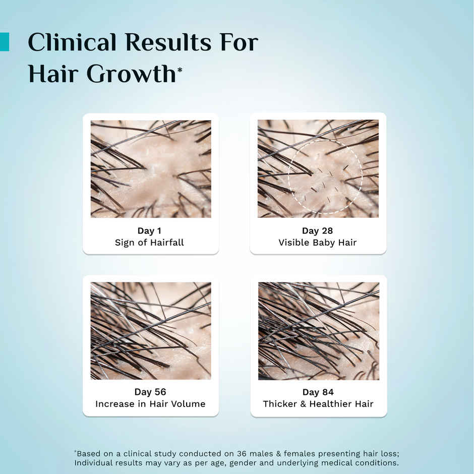 Pilgrim Advanced Hair Growth Serum with Redensyl & Anagain Reduces Hair Fall & Boosts Hair Growth