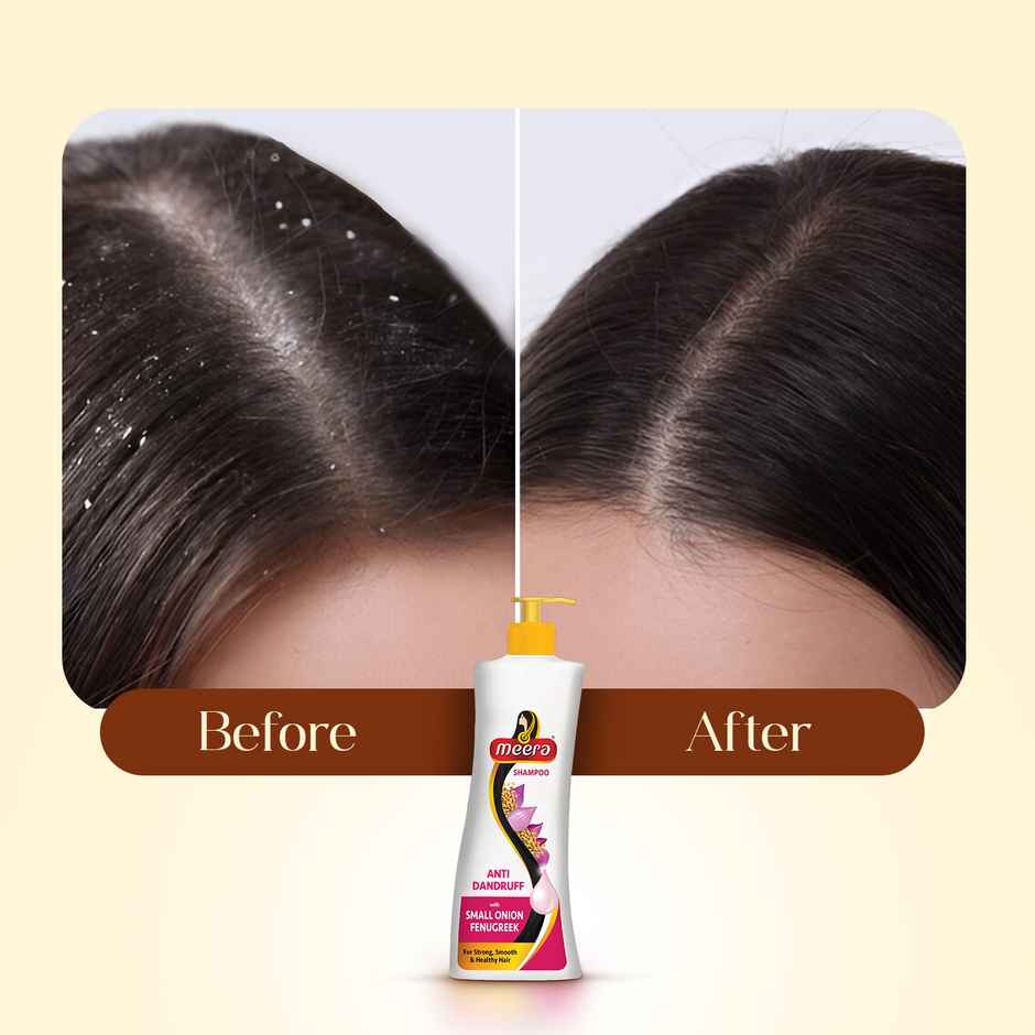 Meera Anti Dandruff Shampoo With Small Onion and Fenugreek