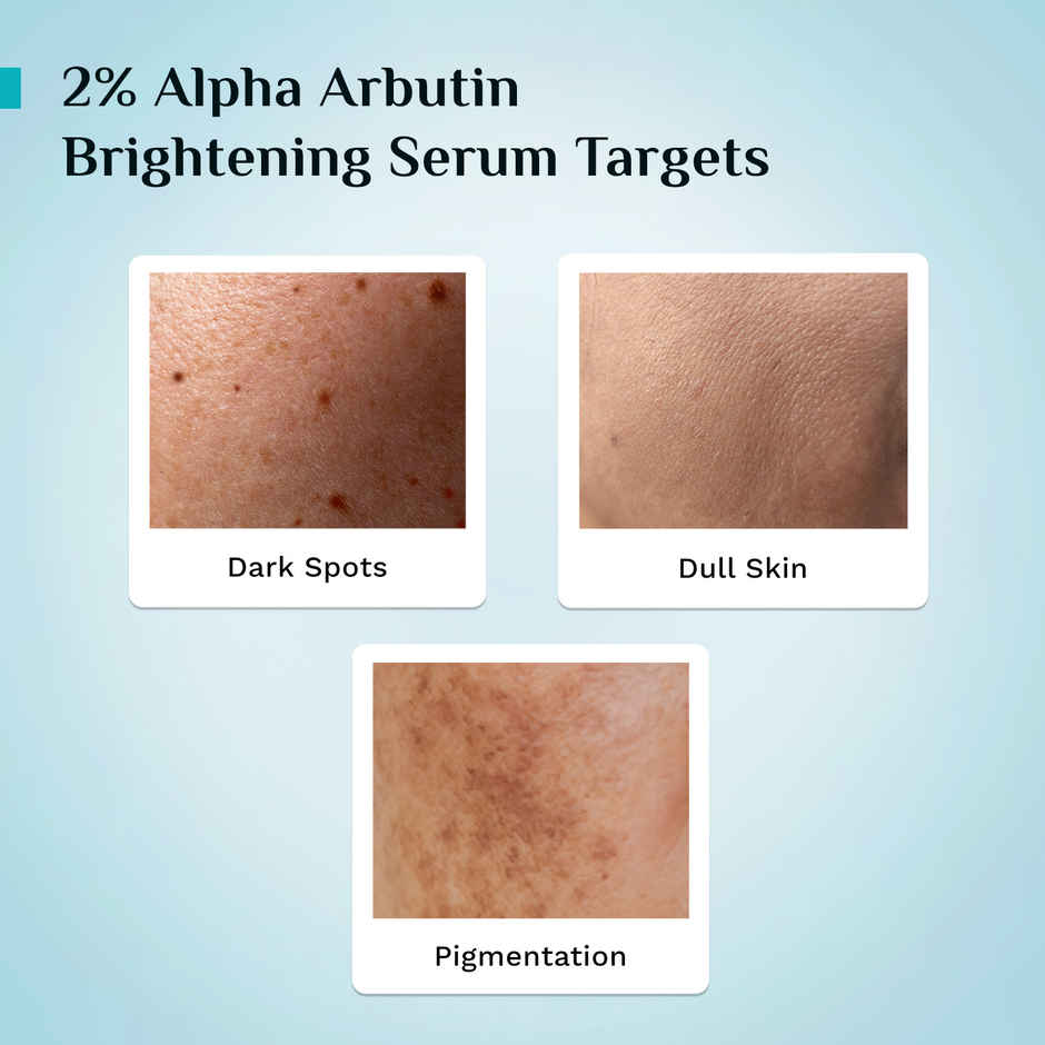 Pilgrim Brightening Skin Face Serum with 2% Alpha Arbutin & 3% Vitamin C for Pigmentation & Glow