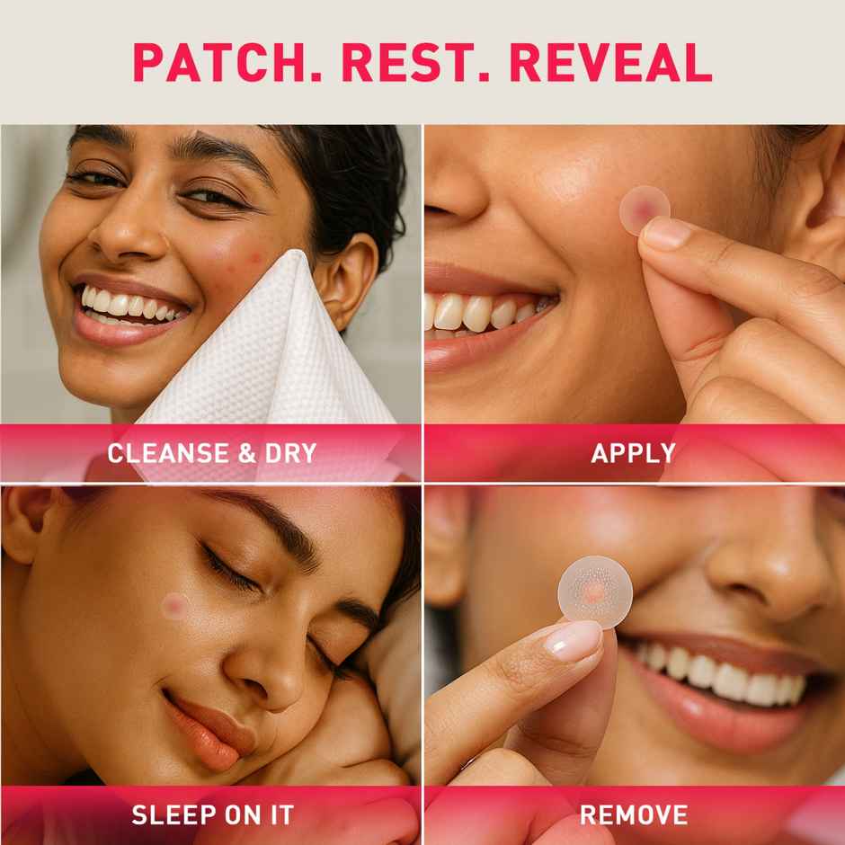 Sirona Acne Pimple Patch For Face For All Skin Types