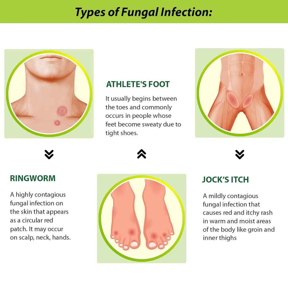 Tetmosol Fresh Lime Fragrance Dusting Powder