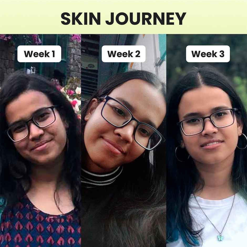 Cos-Iq Niacinamide Vitamin B3-5 Face Serum