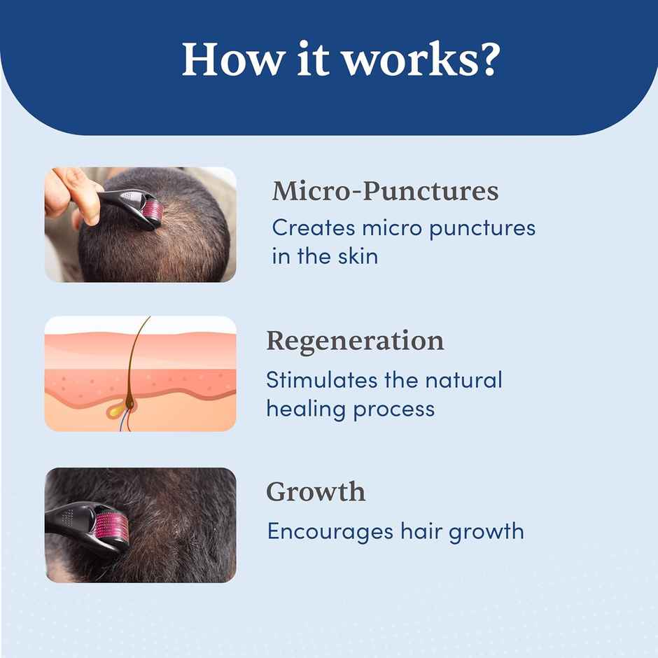 Man Matters Derma Roller 1.00mm with 540 Titanium Needles Promotes Beard Growth & Reduce Acne Scars