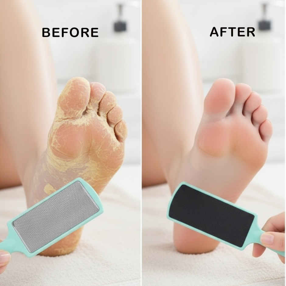 Midazzle 2in1 Foot Filer/Scrubber and Callus Remover - Large |MIFF5208