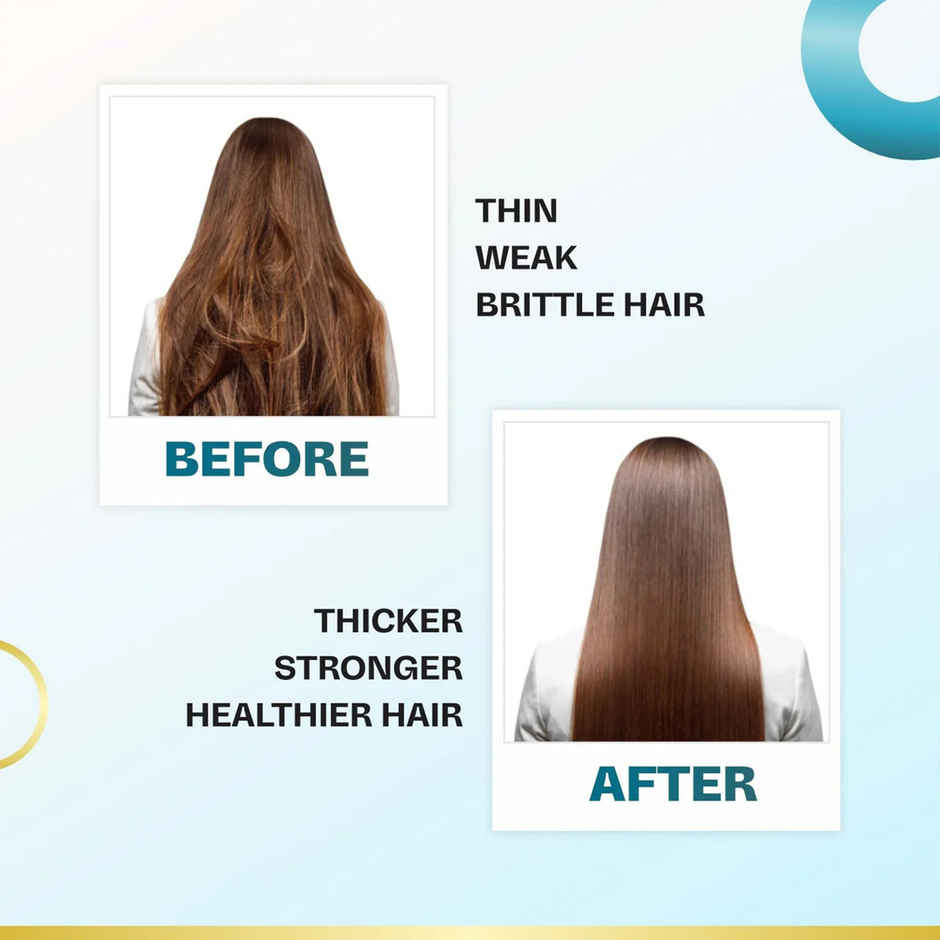 KT Professional 3X Hair Growth Serum with Black Cumin | Anagain, Hibiscus & Redensyl