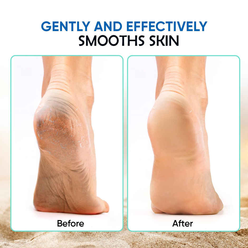 Midazzle 4in1 Foot Filer Pedicure Brush, Pumice Stone, Scrubber |MIFF5202 | Assorted